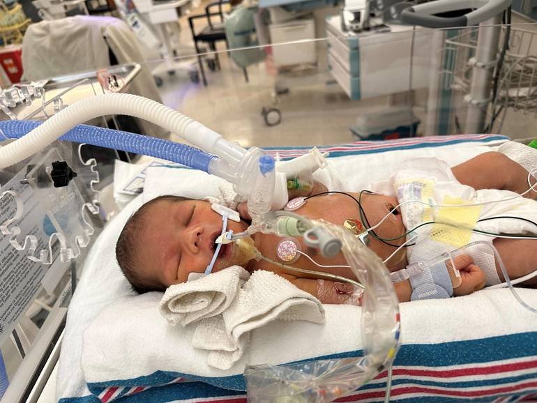 Understanding the Importance of NICU Care for Newborns